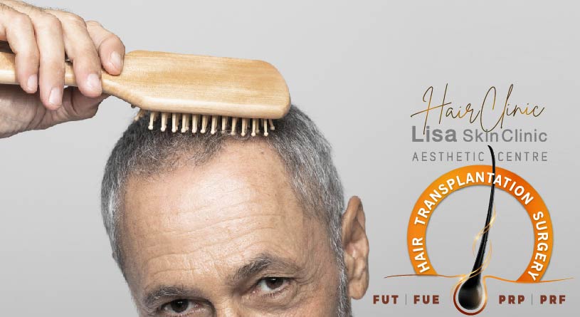 best hair transplantation surgery using FUT, FUE, PRP, PRFat lisa hair clinic, calicut, kerala