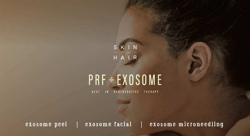 combining PRF and Exosome for skin and hair rejuvenation at Lisa Skin Clinic aesthetic Centre, Calicut, Kerala