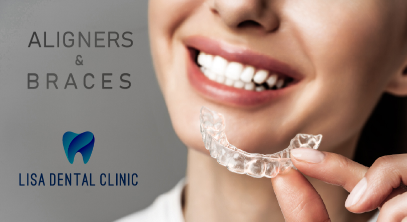 Premium Dental treatment at Lisa Dental Clinic. Special Dental Procedures and speciality dental offerings in Calicut, Kerala, India