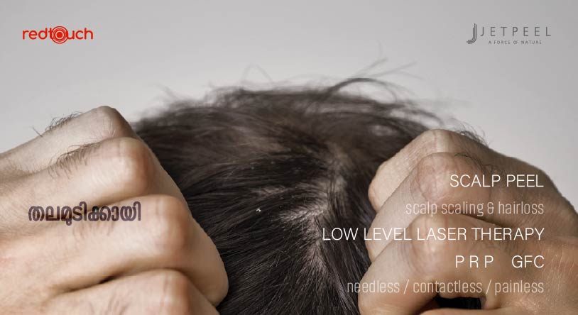 Hair Rejuvenation treatment for  hair loss, Male pattern baldness, Female pattern hair loss, sudden severe hair loss due to various causes, Dry dull ,lusterless hair AT aesthetic centre in calicut by board certified dermatologist certified by A4M - American Academy of Anti-Aging Medicine